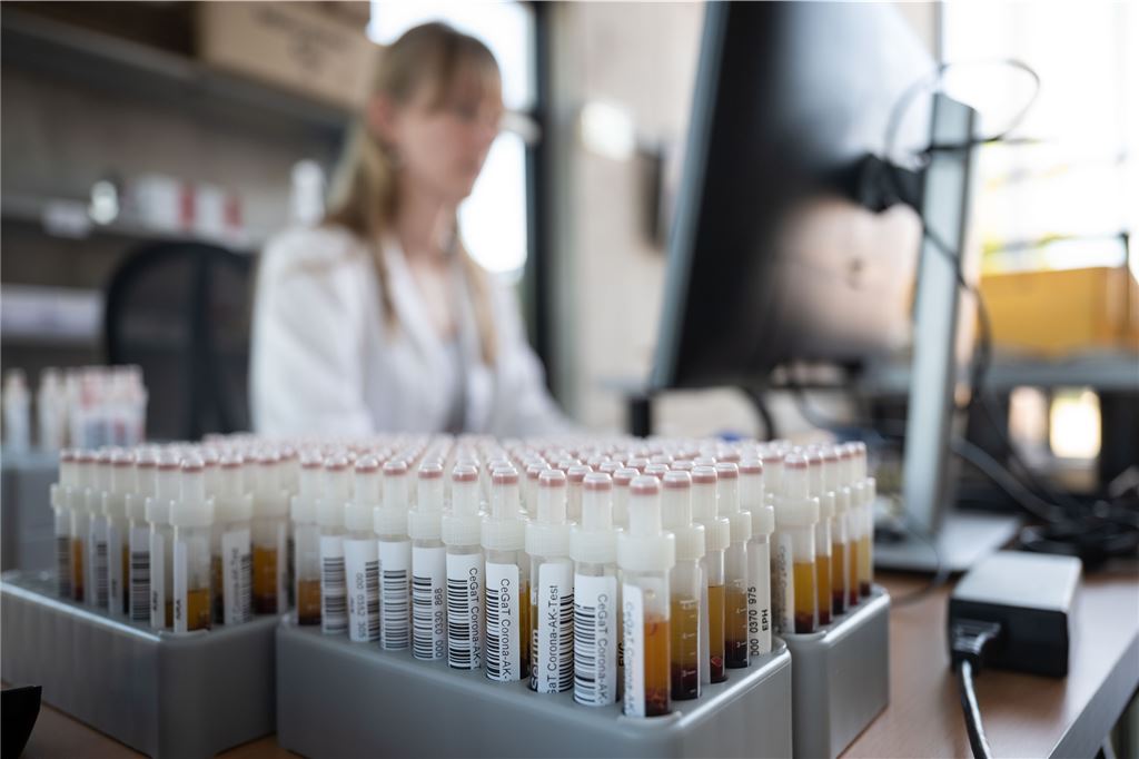 Antikörper-Tests lösen bei Kamener Paar Kettenreaktionen aus Der Antikörper-Wert wird mit Hilfe einer Blutprobe analysiert. Ein Kamener Paar hat sich zur selben Zeit mit den selben Impfstoffen impfen lassen und völlig unterschiedliche Ergebnisse erhalten.