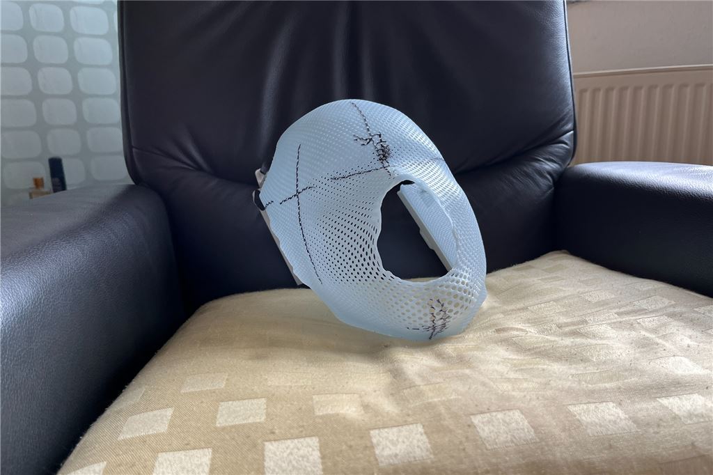 Josef Schürmann hat zum fünften Mal Krebs und bleibt positiv Diese Maske trugt Josef Schürmann bei seiner letzten Behandlung im Krankenhaus in Dorsten, um den Lungentumor zu behandeln.